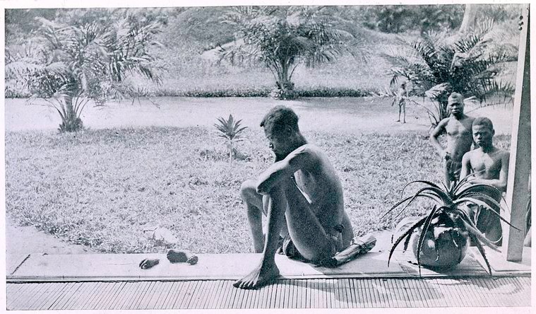 Original caption: "Foot and hand of child dismembered by soldiers, brought to missionaries by dazed father". (A father stares at the hand and foot of his five year-old daughter, which were severed as a punishment for having harvested too little caoutchouc/rubber.